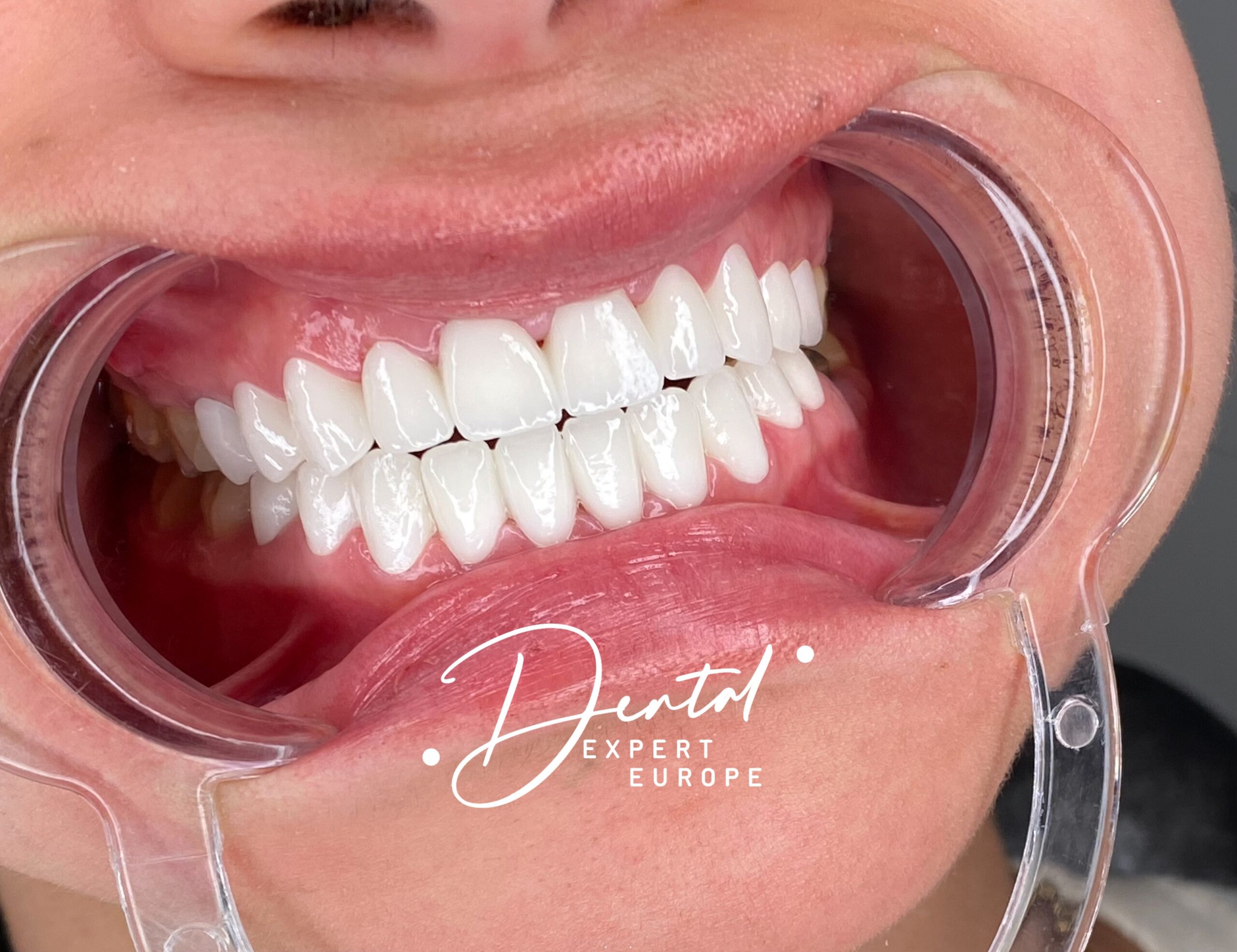 Smile Club Dental Expert Clinic